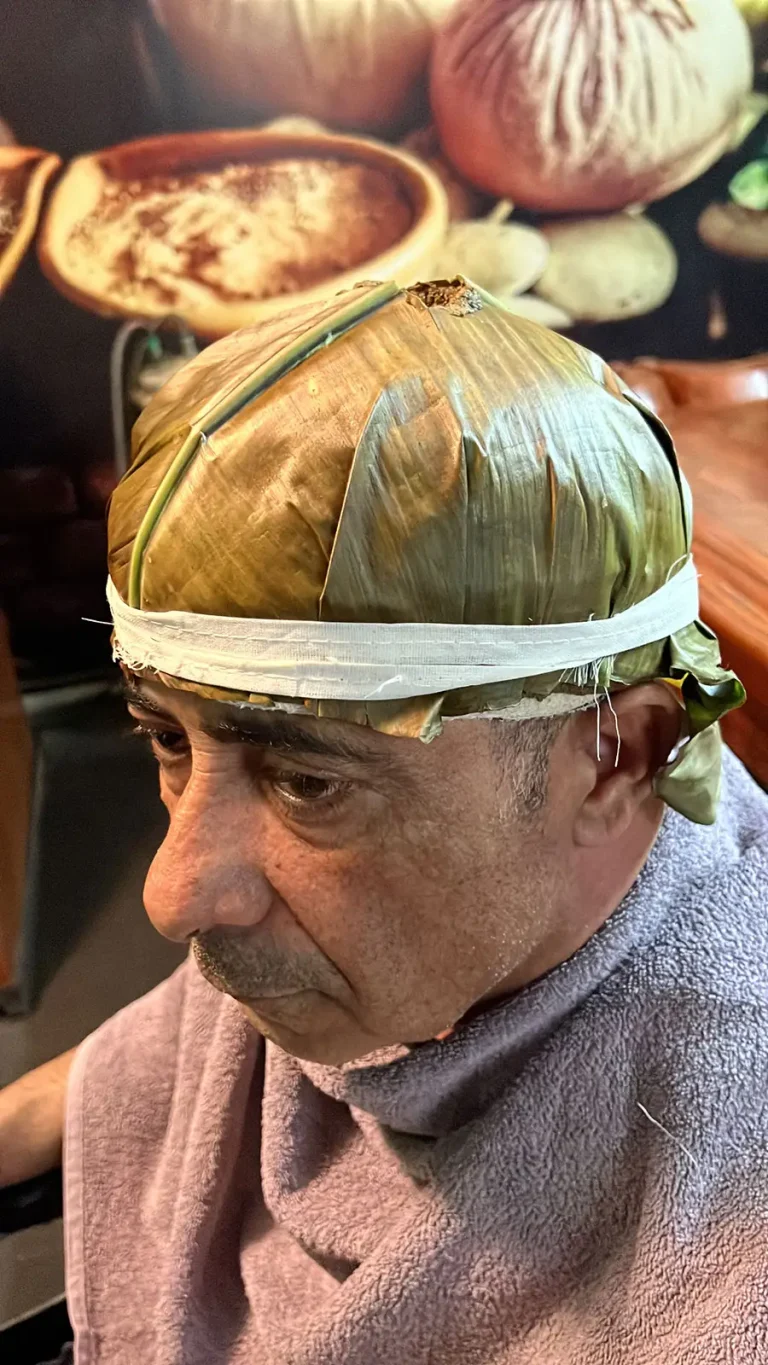 Takradhara and Lepa Medicated Buttermilk Therapy for Scalp and Skin Cooling at Shri Vishwavedhika Kharadi Pune