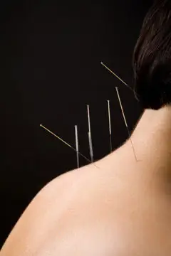 Agnikarma Thermal Micro-Cautery Pain Management Therapy at Shri Vishwavedhika Kharadi Pune